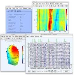 image processing matlab